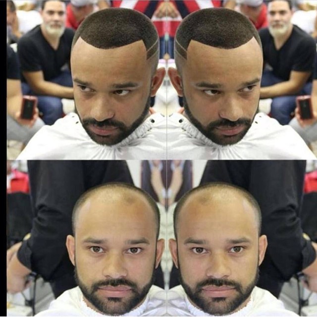 Hair illusion Hair Loss Bald Thinning Hair Loss Fibers Concealer Jet Black 38.5G