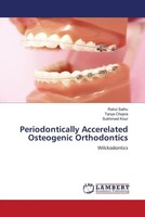 Rahul Sathu (U. A.) | Periodontically Accerelated Osteogenic Orthodontics | Buch