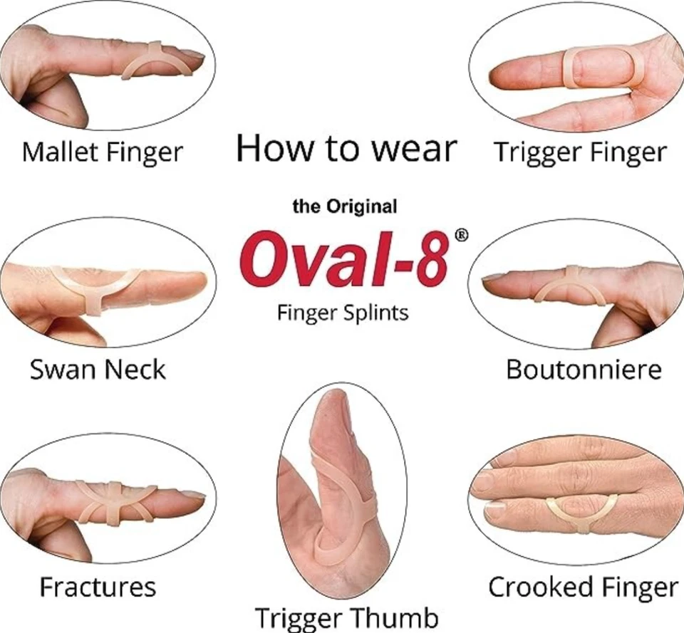3-Point Products Oval-8 Finger Splint - Choose Your Size - Image 3 of 4
