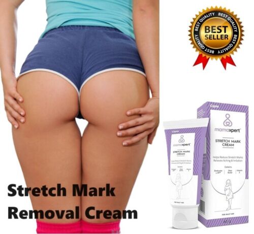 100% Natural Stretch Mark Removal Cream For Women Reduce Stretch Marks 60g - Picture 1 of 10