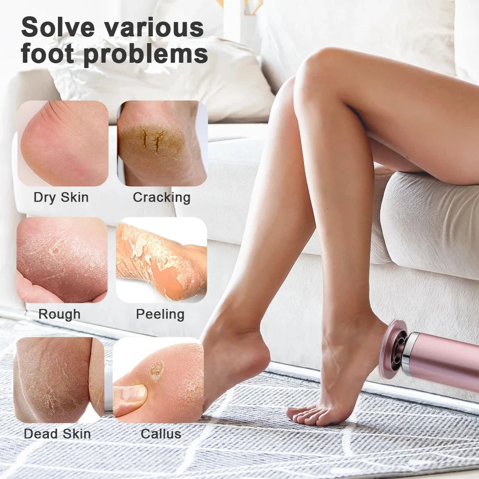 Electric Foot Callus Remover Heels Remove Dead Skin Pedicure Tool Foot Heel Tool - Image 4 of 4