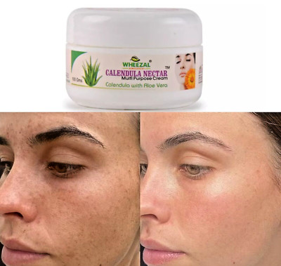 Wheezal Glow Bright Calendula Nectar Cream with Aloe Vera (100g)