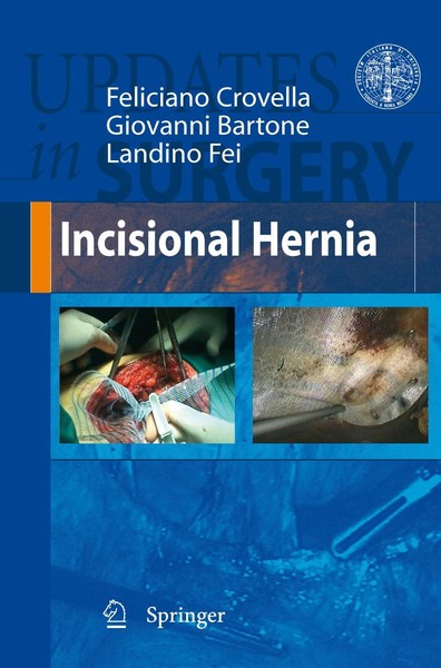 Incisional Hernia Feliciano Crovella-image