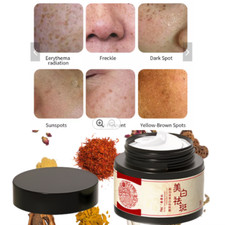 Crema de eliminaci n de pecas potente Extracto de plantas de hierbas naturales