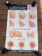 VINTAGE 1962 SIMILAC POSTER MAMMARY GLANDS BREAST FEEDING ROSS LABORATORIES