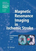 Magnetic Resonance Imaging In Ischemic Stroke Tobias Back