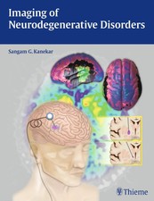 Imaging of Neurodegenerative Disorders | Sang...