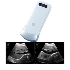 Wireless Convex Ultrasound Probe 3.5-5MHz 80E Portable Scanner - Medical Diagnos