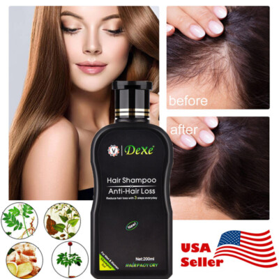 Dexe Anti Hair Loss Shampoo Natural Herbal Hair Growth Treatment Hair Regrowth
