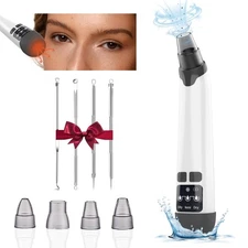 Blackhead Remover Vacuum - 3 Suction Levels, 4 Tools, Acne Extractor