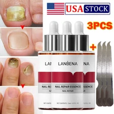 3PCS LANBENA Fungal Nail Repair Essence Serum + Nail File Hand & Foot Treatment