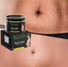 Best Scar Removal-Cream for Old-Scars Stretch Mark Removal Cream UNISEX 100g