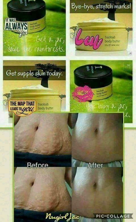 nu skin stretch mark cream