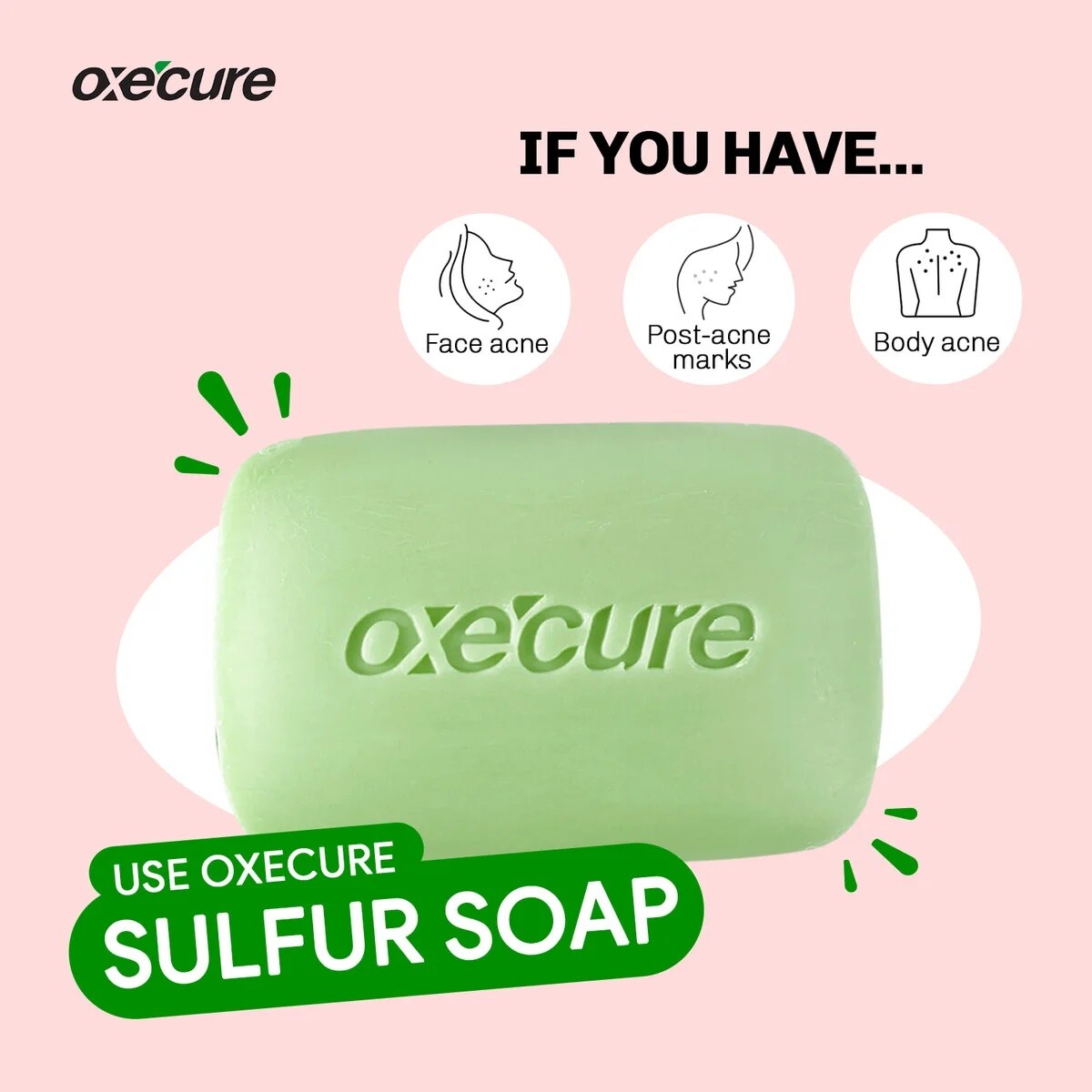 Big size 100g x 2 Oxe Cure Sulfur Soap for Face, Body Oily Acne Prone