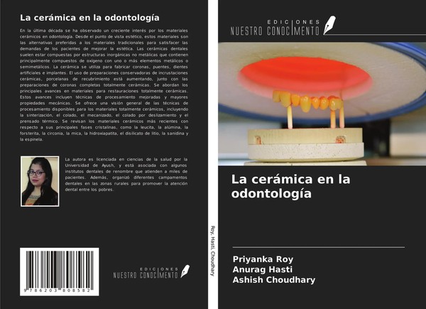 Priyanka Roy (U. A.) | La CeráMica En La OdontologíA | Taschenbuch | Spanisch-image