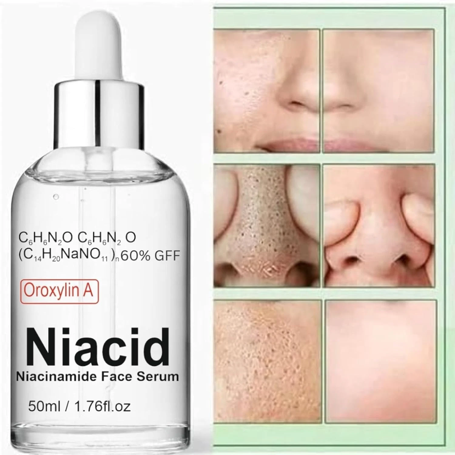 Natural Niacid Face Serum 10% Niacinamide For Skin Brightening Dark Circle 50ML
Opens in a new windo