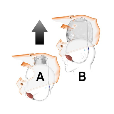 #ad #ad Simpson Safety 0895 01 30 CO2 Inflator Eject Helmet Removal System Kit $31.19