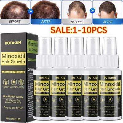 BOTASUN 5% Minoxidil Hair Growth Serum Spray for Healthier and Thicker Hair, 60mL