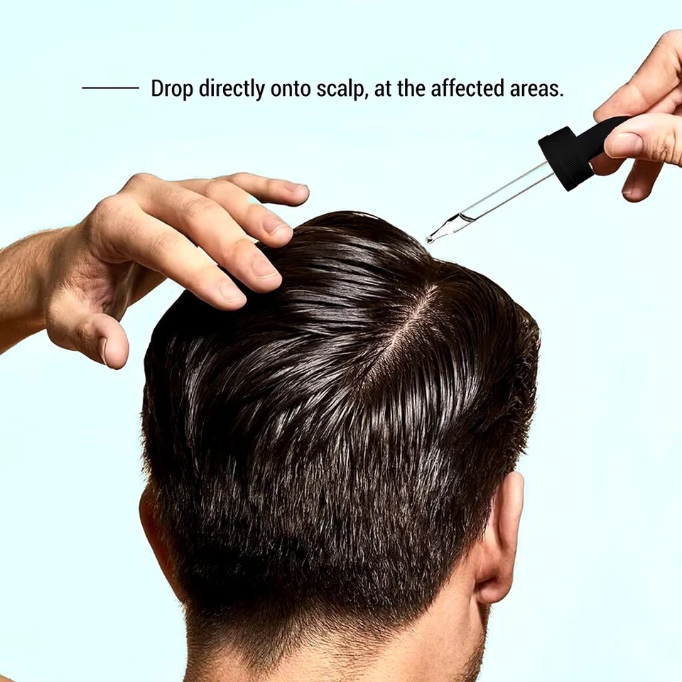 Beard & Hair Growth Serum 3 x 30ML 10% 054P 5% Minoxidil Regrowth In A Week - Image 2 of 4