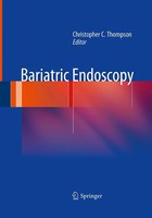Christopher C. Thompson | Bariatric Endoscopy | Taschenbuch | Englisch (2016)