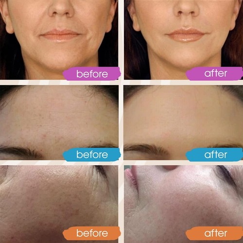 Suero de retinol para rostro - Suero facial de vitamina C con suero de ácido hialurónico PACK DE 3 unidades - Imagen 5 de 6