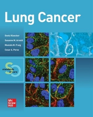 Lung Cancer: Standards of Care by Goetz Kloecker (English) Paperback Book