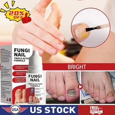Fungi Nail Anti Fungal Liquid Formula Nail Repair Liquid Solution 15ml