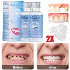 2XTemporary Tooth Repair Granules Temporary Tooth Fitting Beads Teeth Solid Glue