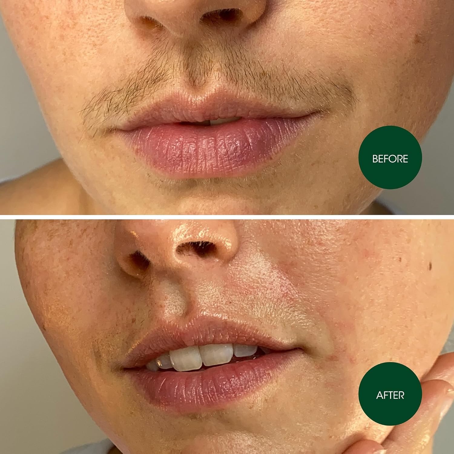 Hypoallergenic Facial Wax Strips for All Skin Types - Effective Hair Removal Kit