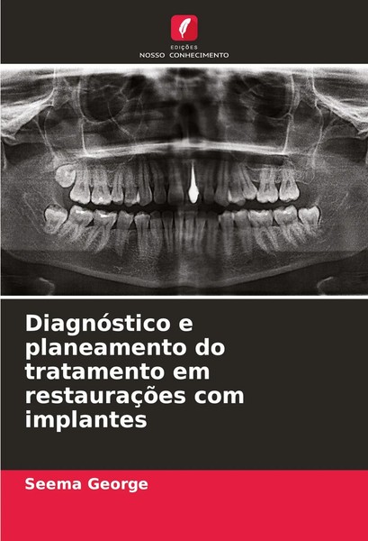 Seema George | DiagnóStico E Planeamento Do Tratamento Em RestauraçõEs Com...-image