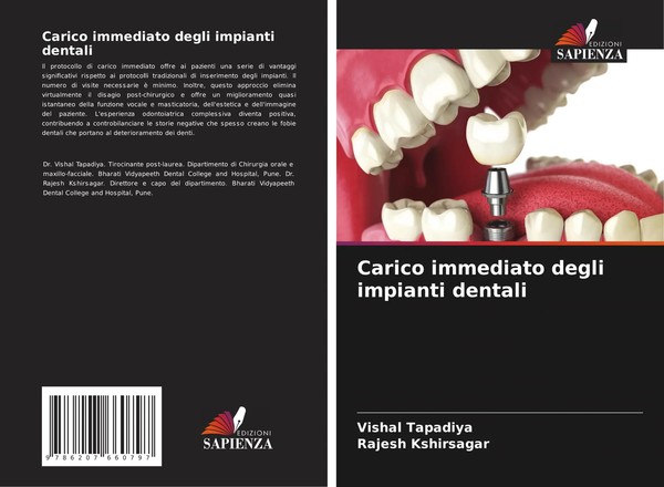 Vishal Tapadiya (U. A.) | Carico Immediato Degli Impianti Dentali | Taschenbuch-image