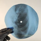 BEATLES A DAY IN THE LIFE X-Ray USSR Record Roentgen Bone Ribs Music Vinyl