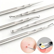 Blackhead Whitehead Comedone Extractor Pimple Remover Facial Skin Tool Acne YNR