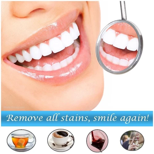 Very Strong Teeth Whitening Gel MADE IN EU 36 Professional Dental Grade 10ml Gel - Picture 20 of 24