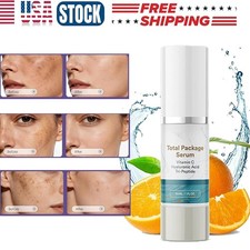 NEW Total Package Serum, All-In-One Vitamin C, Hyaluronic Acid, Peptides Serum