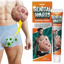 -..Genital Warts Remover Cream Body  Genital Discomfort, Skin Tags