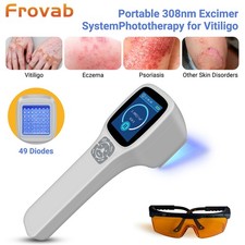 308nm Excimer Light Therapy Device Portable 49 Diodes Skin Conditions Treatment