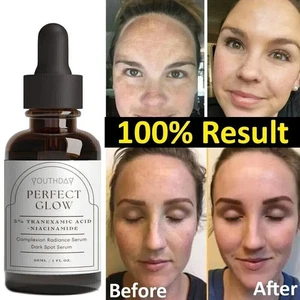 100% Tranexamic Acid Serum 1 fl oz/30ml USA