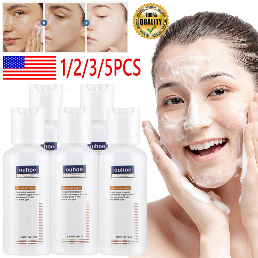 Skinenjoy Cleansing Lotion for Acne Spots Acanthosis Nigricans