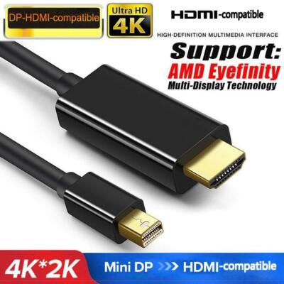 Mini DP DisplayPort Thunderbolt 2 MDP zu HDMI Kabeladapter für iMac New R3