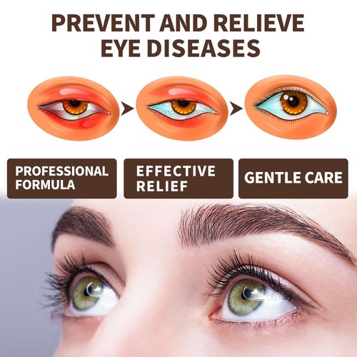 Augenspray für trockene Augen. Natürliches, schmierendes Augenspray. Trockene - Bild 9 von 12