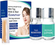 Skin Tag Remover and Repair Liquid Mole Corrector Wart Skintag Foot Corn removal