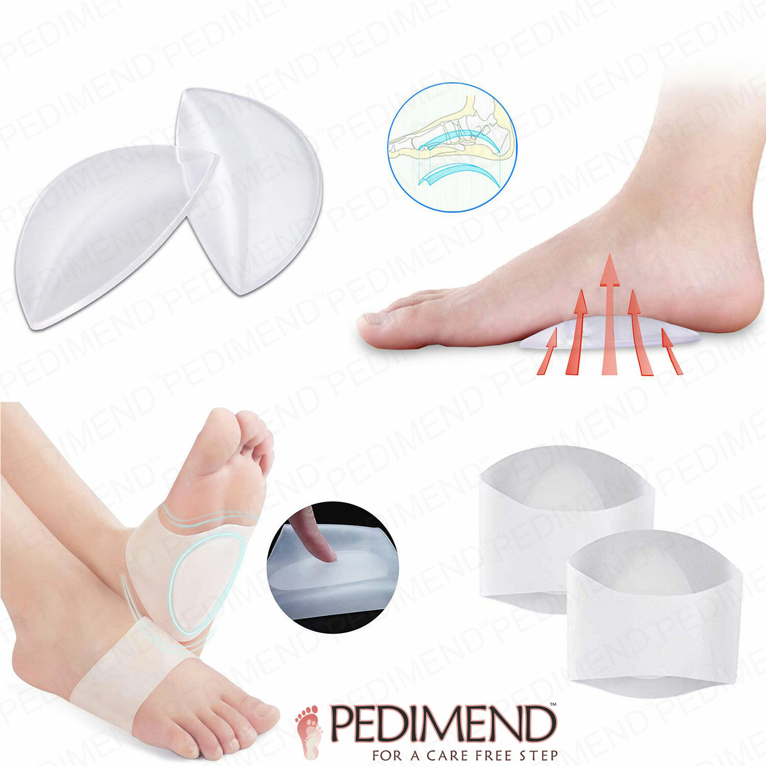 pedimend arch support