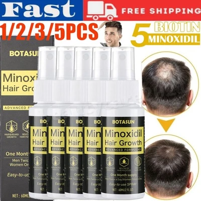 BOTASUN Minoxidil 5% Extra Stärke Männer Haar Regeneration Behandlung 1-5 Monats-Vorrat