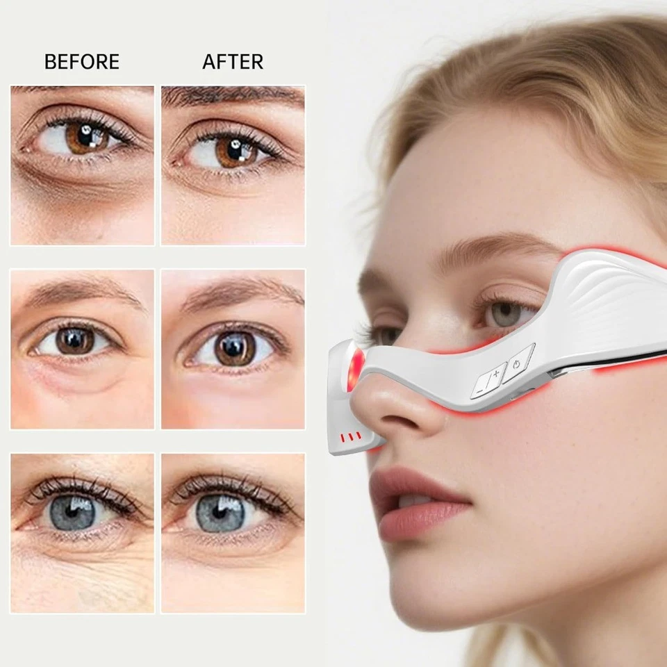 Gafas masajeadoras de ojos con luz roja para reducir la hinchazón de ojeras y las arrugas de los ojos Foto 2 de 4