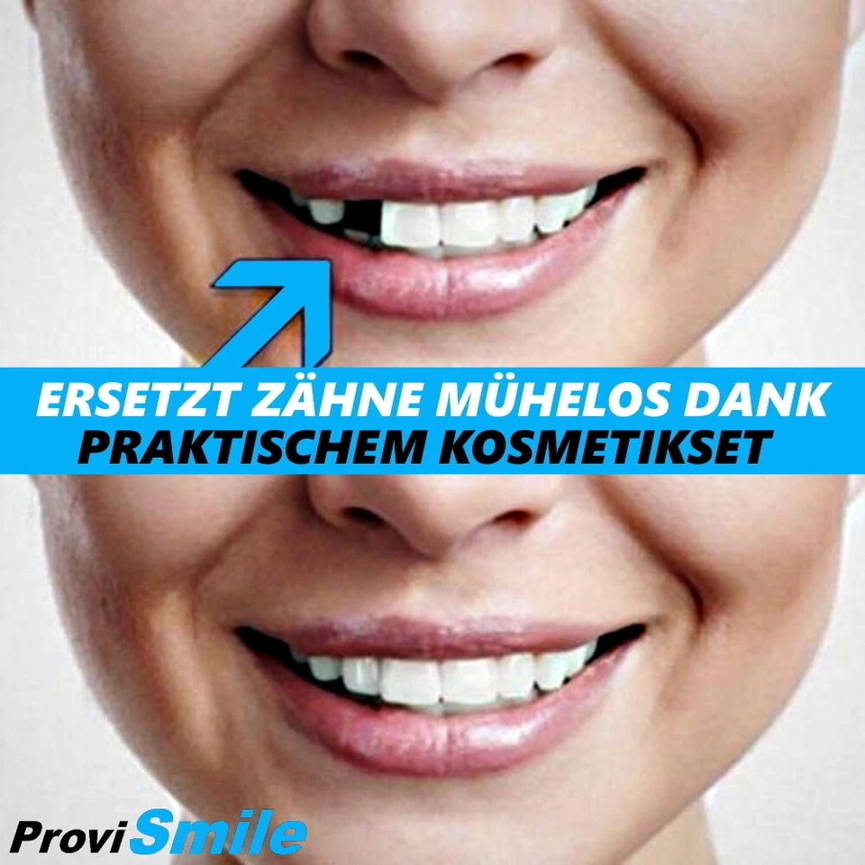 ProviSmile Set Temporary Dentures Temporary Tooth Repair Gap Filling - Image 2 of 4