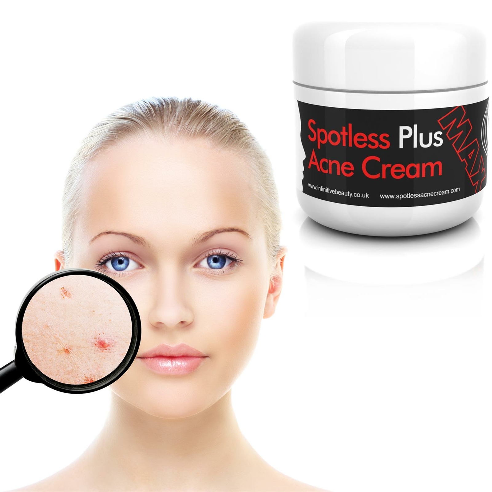 ultraclear acne cream