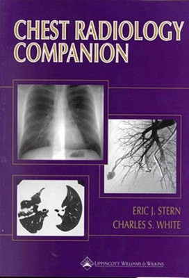 CHEST RADIOLOGY COMPANION: METHODS, GUIDELINES, AND By Stern Eric J. Md & White