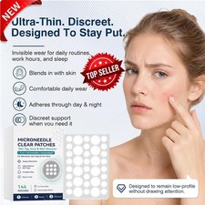 Curalona Microneedle Patches 144pcs, Skin Tag Wart Acne Remover Patches 2026 NEW