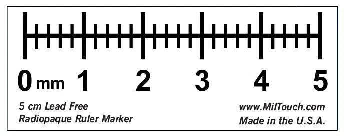 5 cm Digital Style Radiopaque Ruler Marker eBay